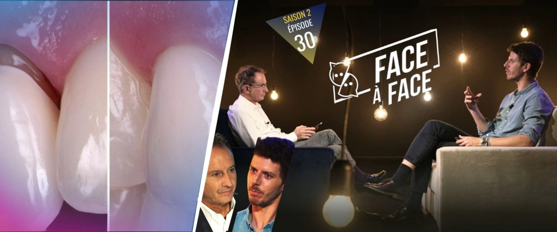 Verti-Prep : Empreinte et Verti-Prep