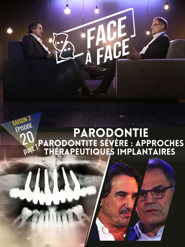 Parodontie : Parodontite sévère : Approches thérapeutiques implantaires