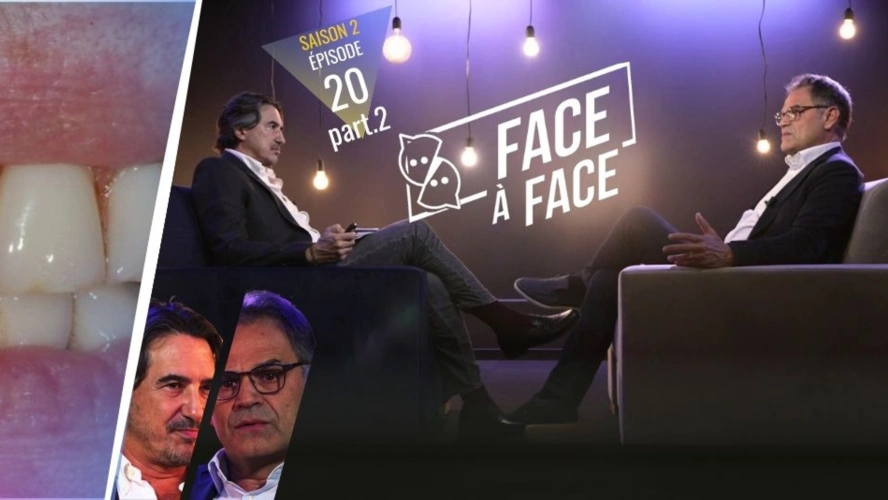 Parodontie : Parodontite sévère : Analyse du sourire