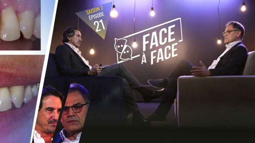 Parodontite sévère et choix thérapeutique : analyse de différents cas