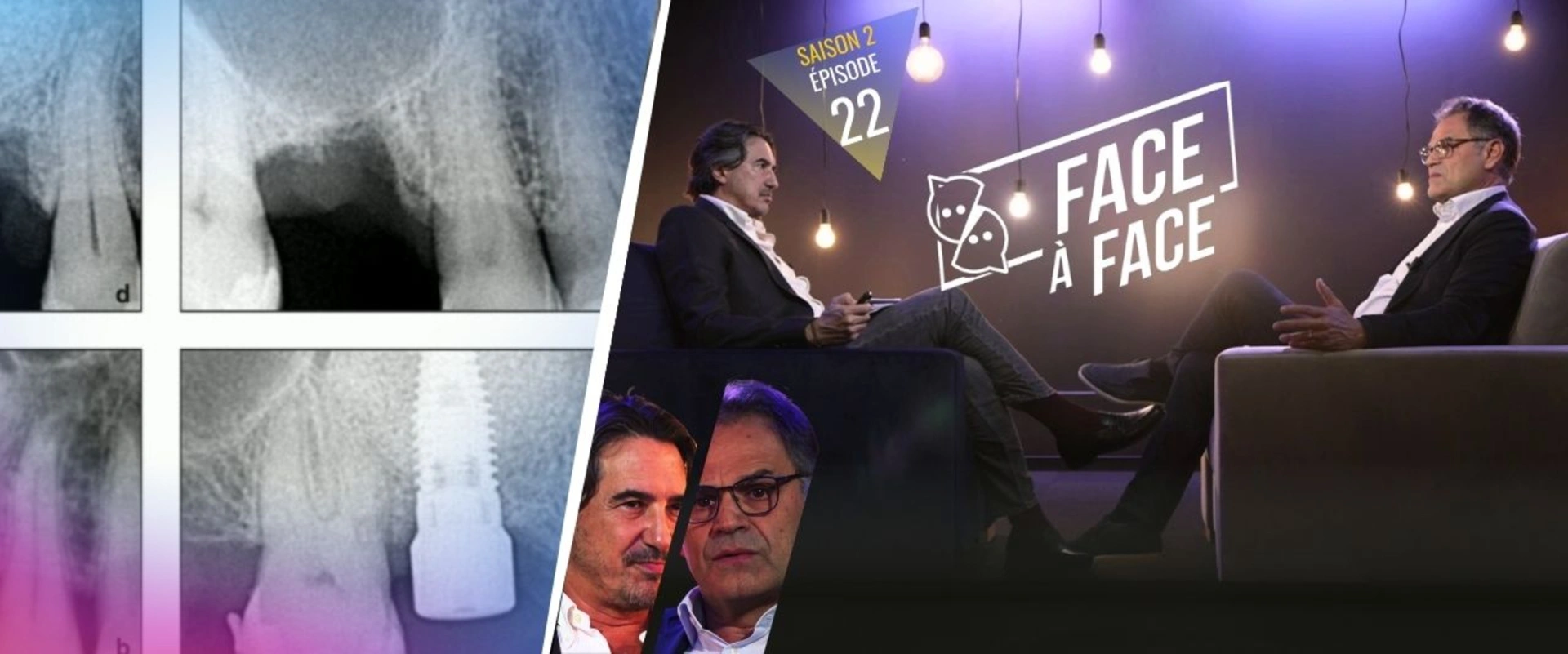 Implant en zircone : une alternative au titane ?