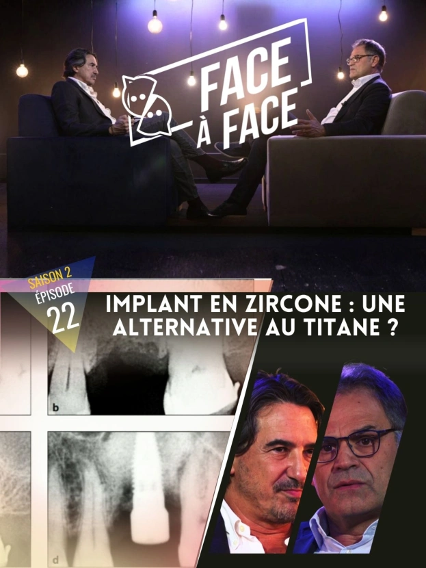 Implant en zircone : une alternative au titane ?
