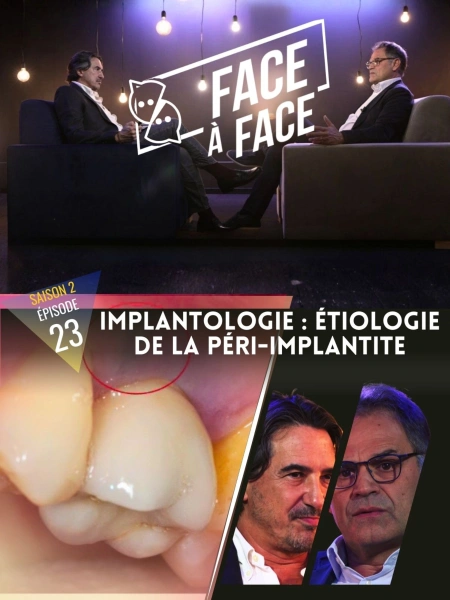 Implantologie : L'étiologie de la péri-implantite