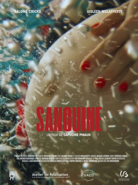 Sanguine