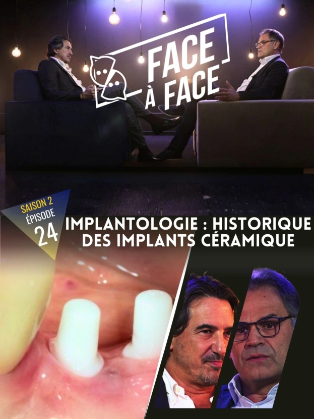 Implantologie : Historique des implants céramique