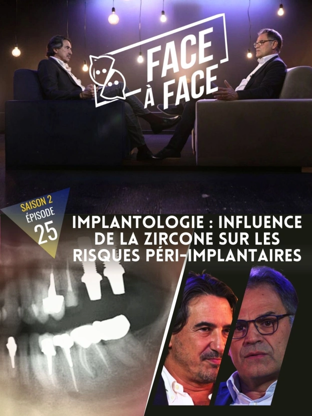 Implantologie : Influence de la zircone sur les risques péri-implantaires