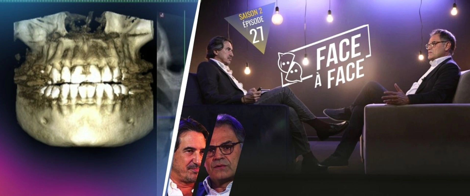 Implantologie : Les chirurgiens-dentistes sont-ils les seuls concernés par les intolérances aux métaux ?