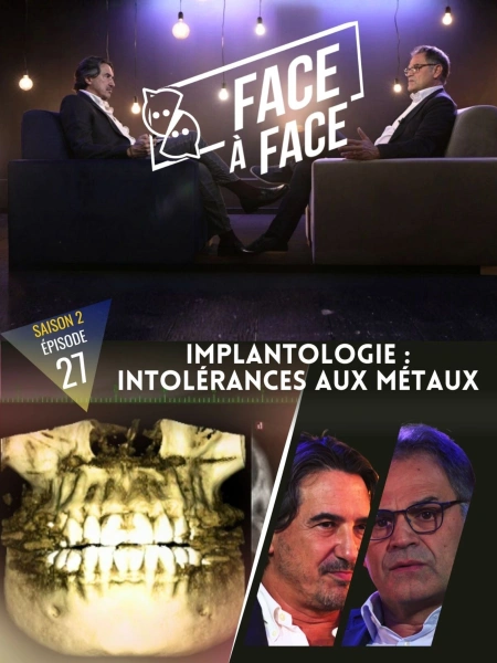 Implantologie : Les chirurgiens-dentistes sont-ils les seuls concernés par les intolérances aux métaux ?