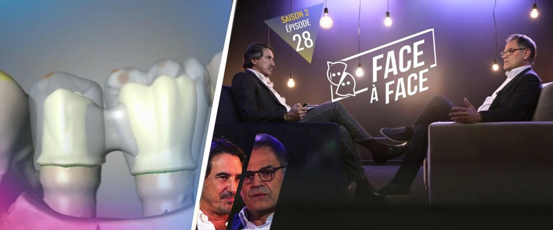 Implantologie : Peut-on utiliser les implants en zircone dans tous les cas ?