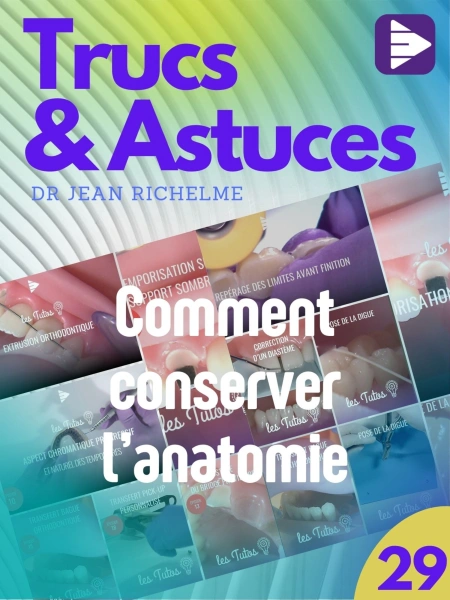 Trucs et astuces : comment conserver l'anatomie ?
