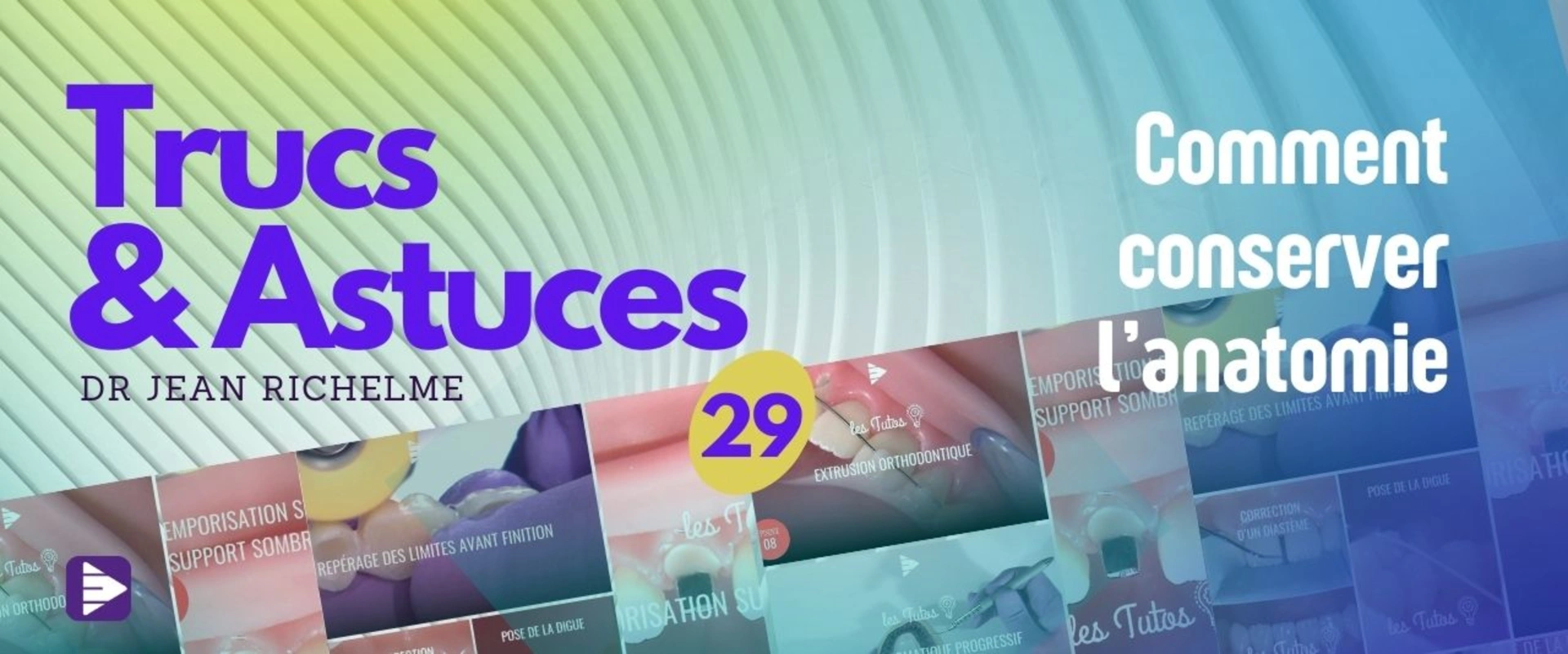 Trucs et astuces : comment conserver l'anatomie ?