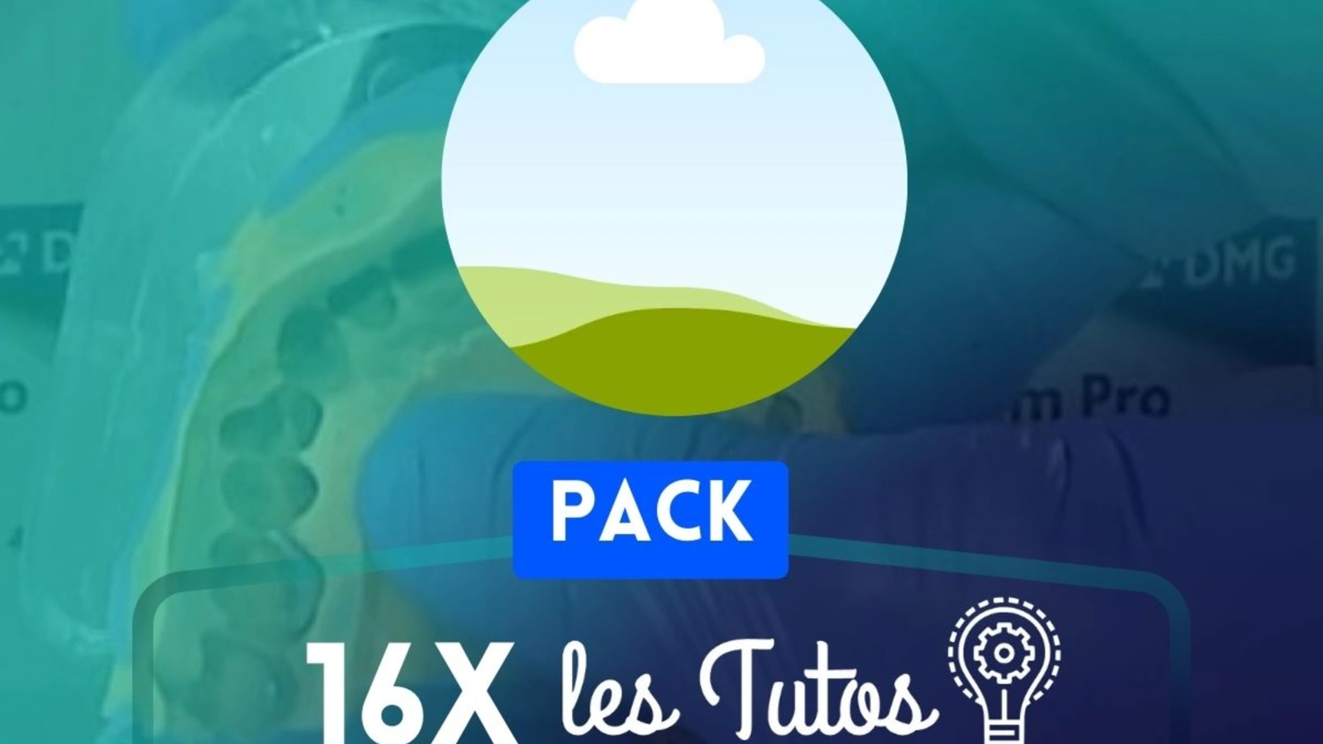 INLAYS-ONLAYS AVEC GAUTHIER WEISROCK