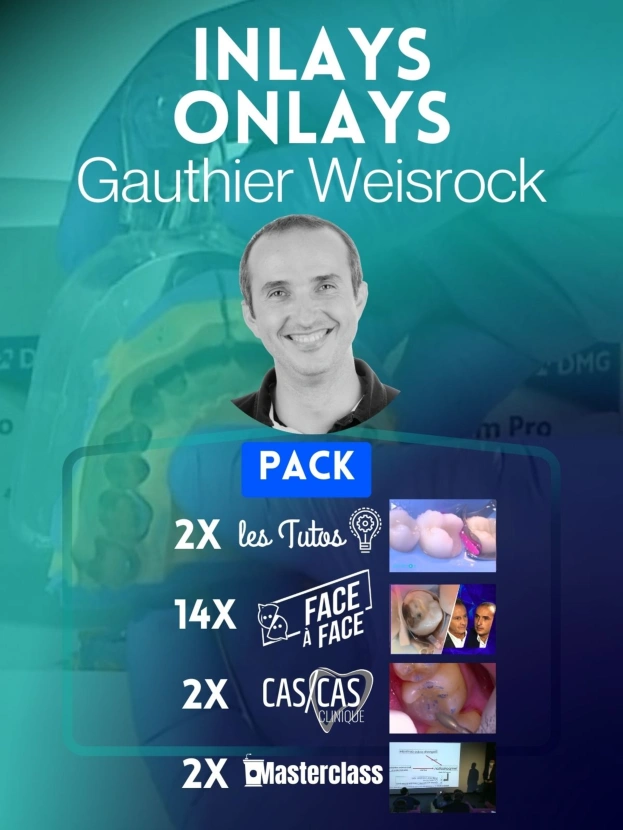 INLAYS-ONLAYS AVEC GAUTHIER WEISROCK