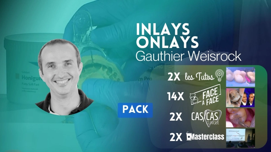 INLAYS-ONLAYS AVEC GAUTHIER WEISROCK