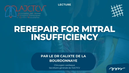 Reprise de plastie pour insuffisance mitrale