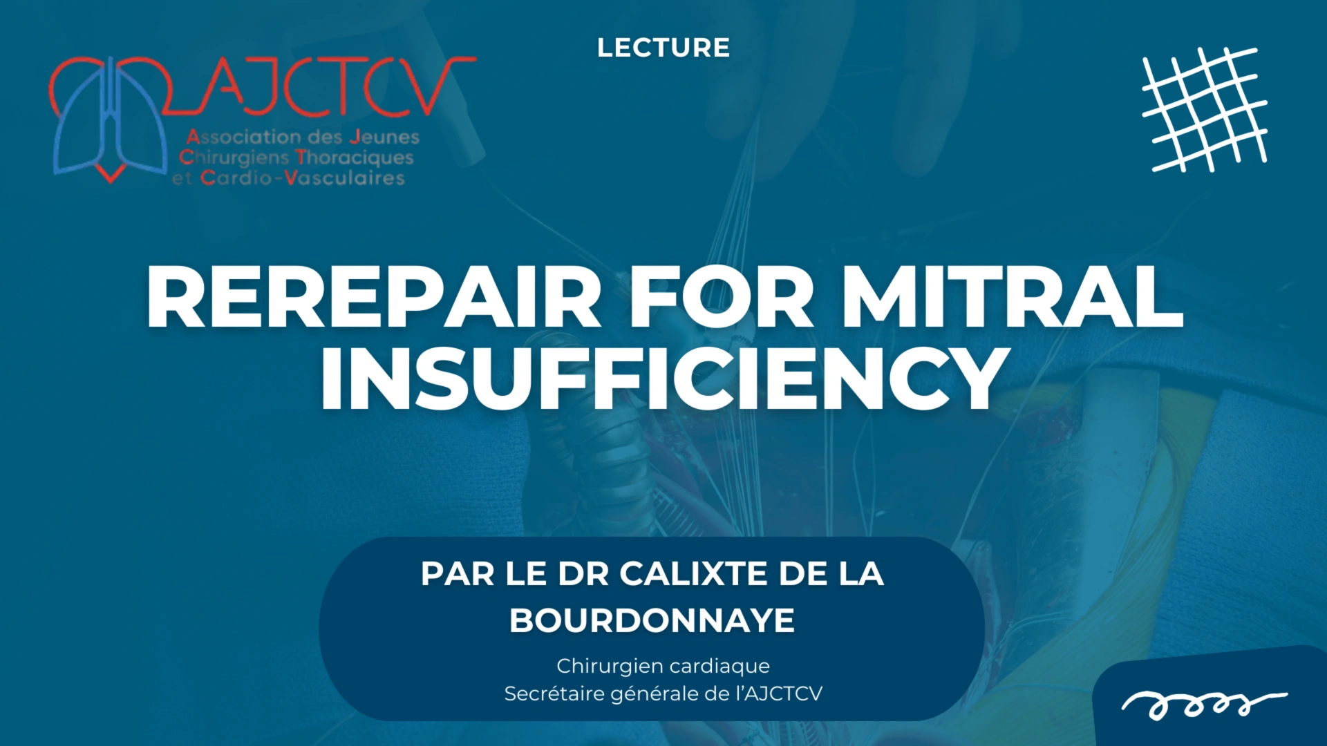 Reprise de plastie pour insuffisance mitrale