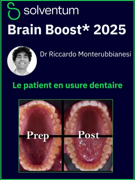 Brain Boost 2025 : Le patient en usure dentaire