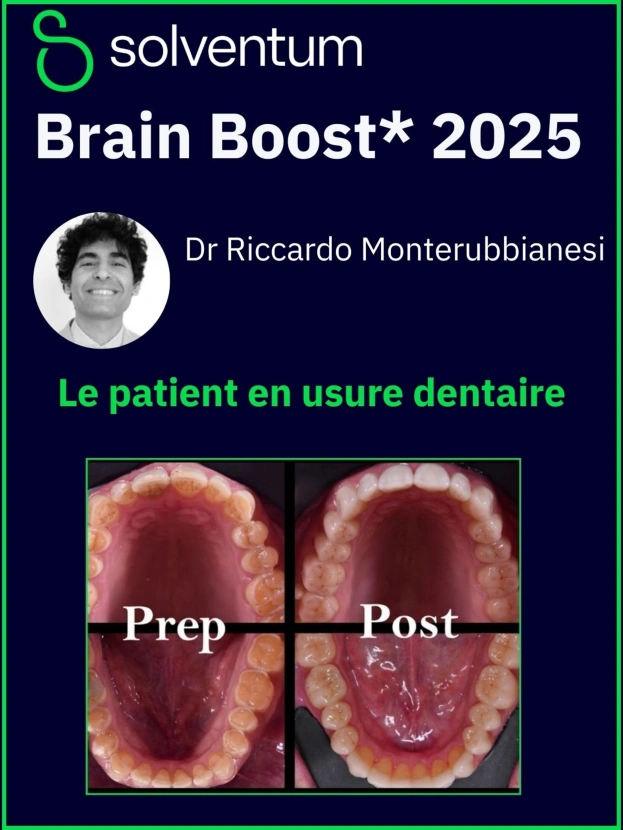 Brain Boost 2025 : Le patient en usure dentaire