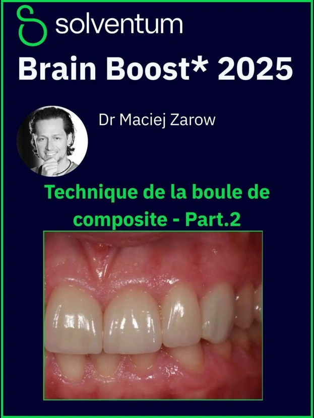 Brain Boost 2025 : Augmentation de la dimension verticale avec les composites directs - Part2 : La technique de la boule de composite