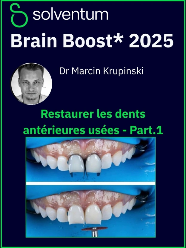 Brain Boost 2025 : Restaurer les dents antérieures usées - Part1
