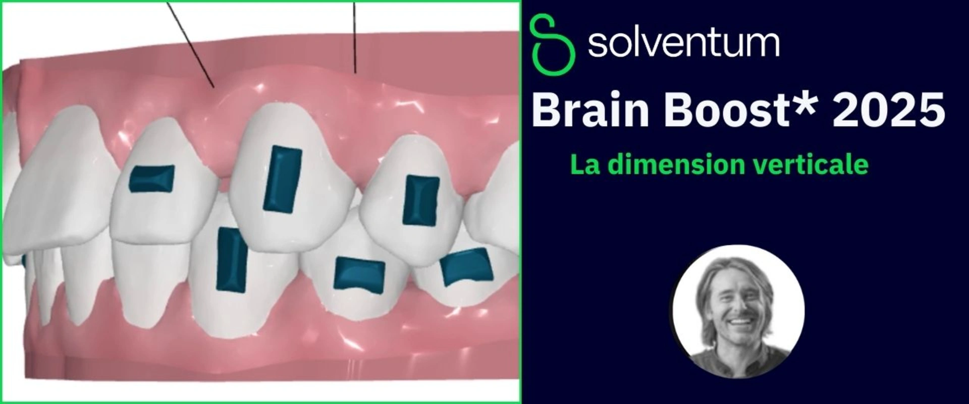 Brain Boost 2025 : La dimension verticale