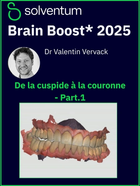 Brain Boost 2025 : De la cuspide à la couronne - Part1
