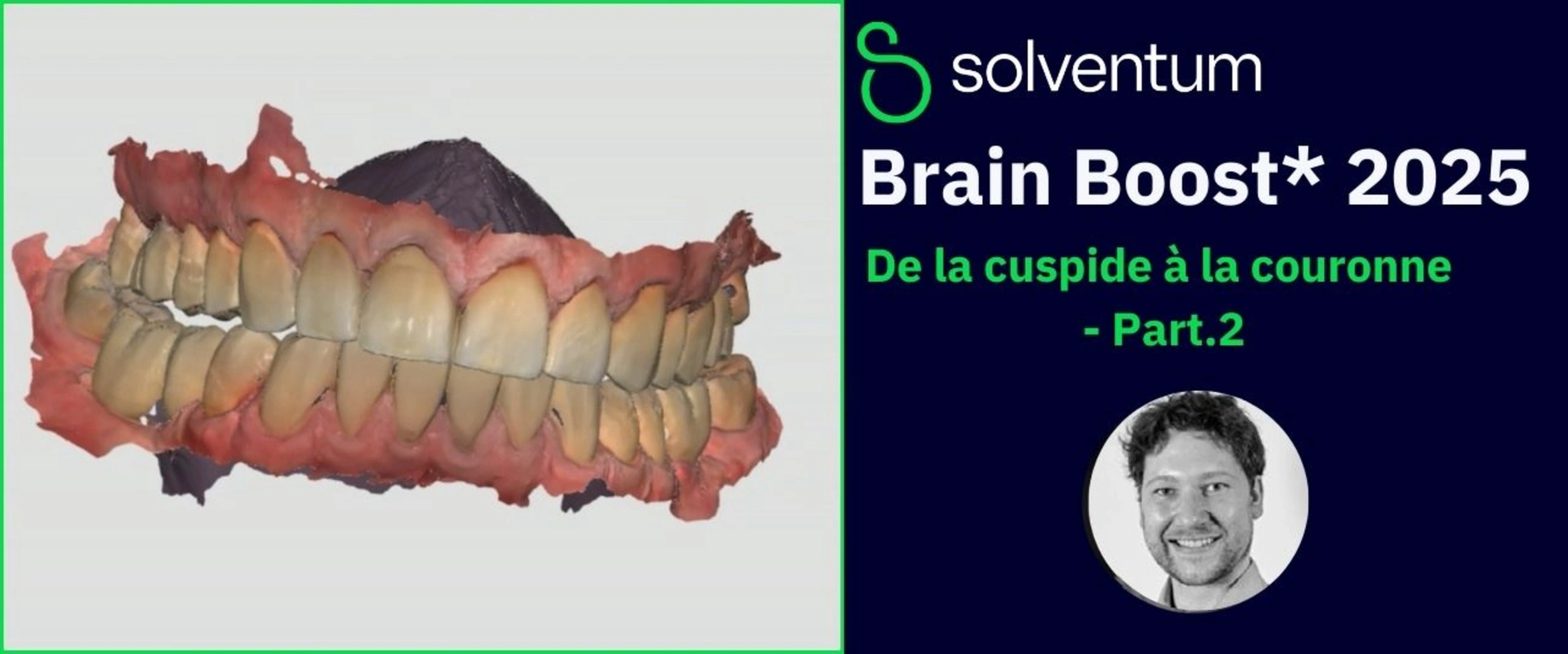 Brain Boost 2025 : De la cuspide à la couronne - Part2