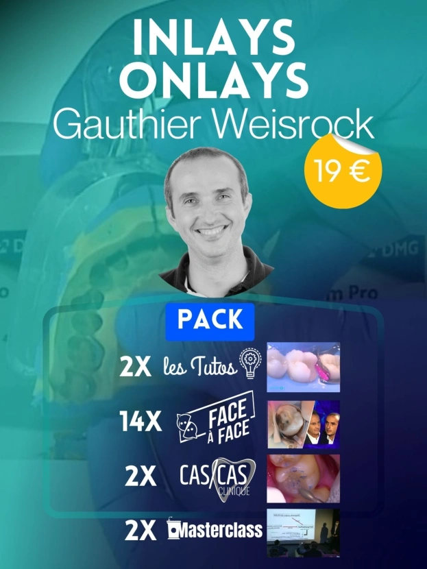 INLAYS-ONLAYS AVEC GAUTHIER WEISROCK