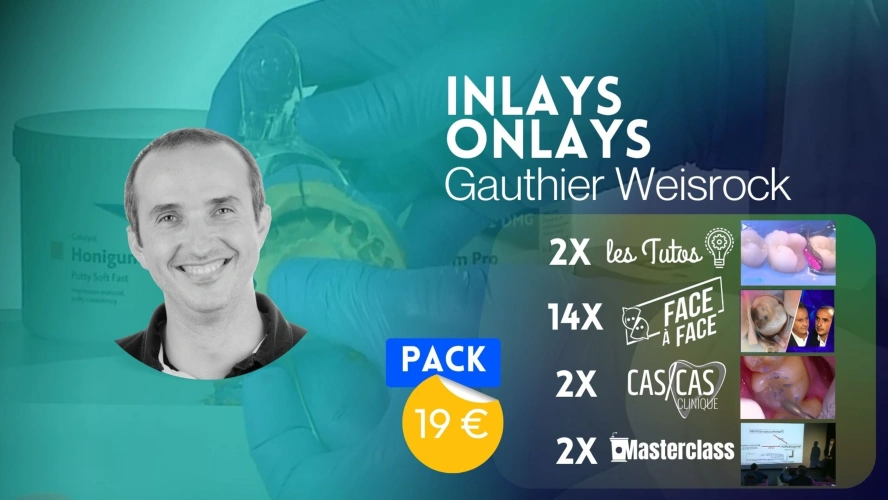 INLAYS-ONLAYS AVEC GAUTHIER WEISROCK