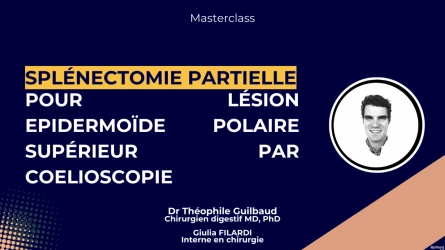 Splénectomie partielle pour lésion epidermoïde polaire supérieur par coelioscopie