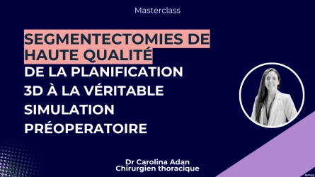 Segmentectomies de haute qualité : De la planification 3D à la véritable simulation préopératoire