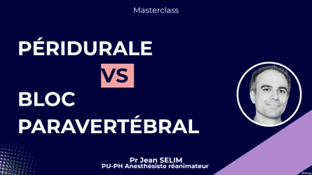 Péridurale vs bloc paravertébral