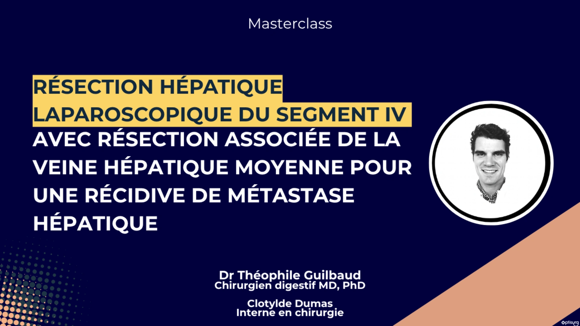 Résection hépatique laparoscopie du segment IV avec résection associée de la veine hépatique moyenne pour une récidive de métastase hépatique