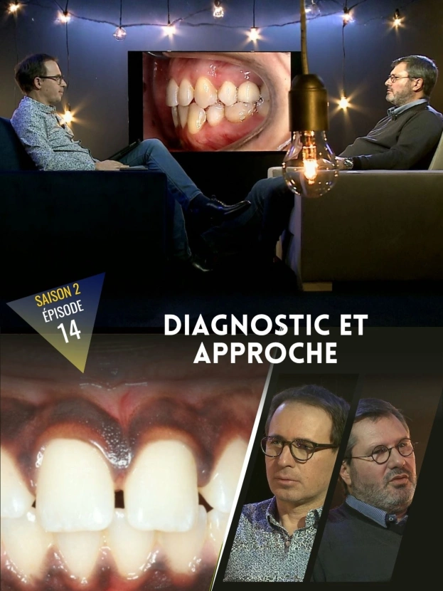 Othodontie : La canine incluse maxillaire, diagnostic et approche