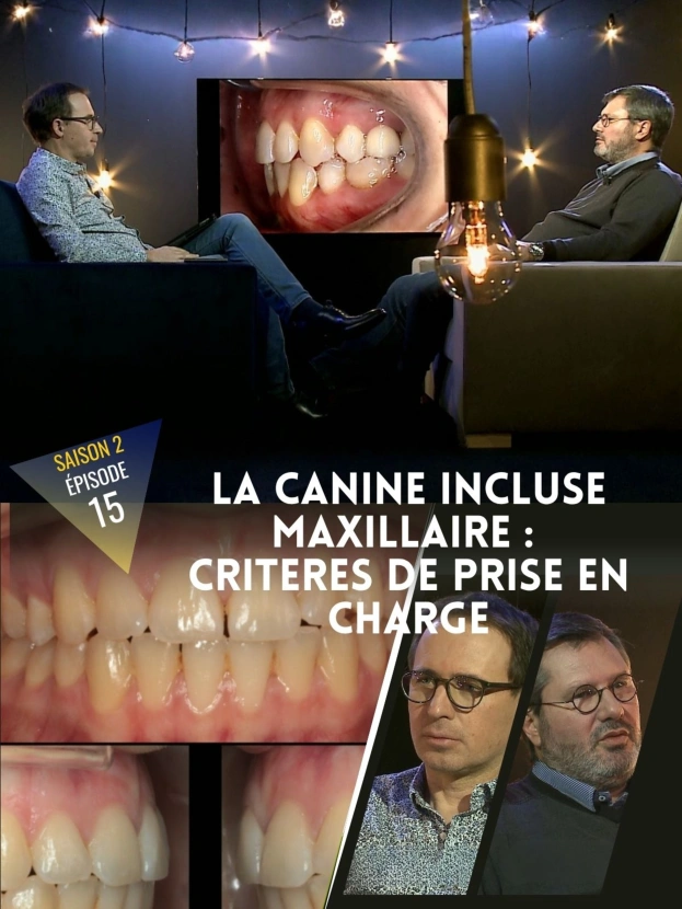 Orthodontie : la canine incluse maxillaire, critères de prise en charge