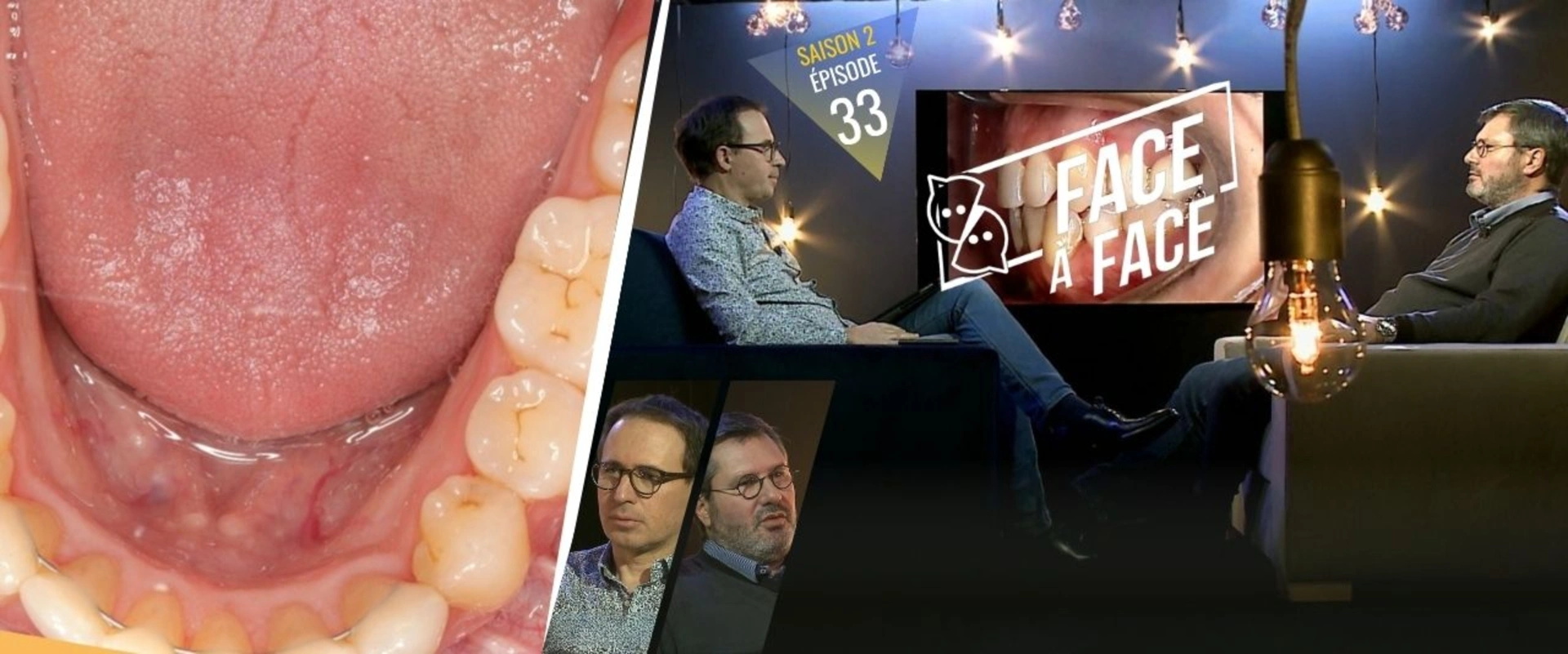Orthodontie : Chirurgie complexe