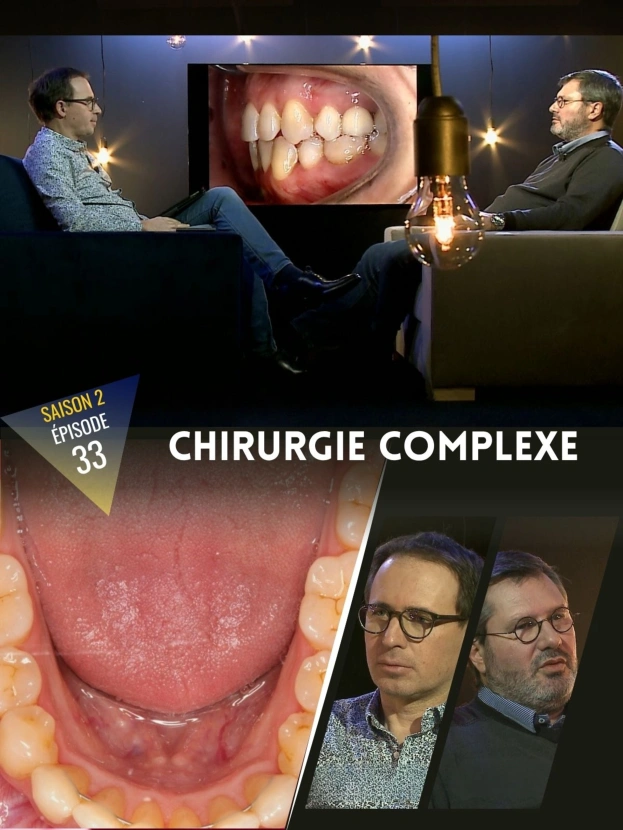 Orthodontie : Chirurgie complexe