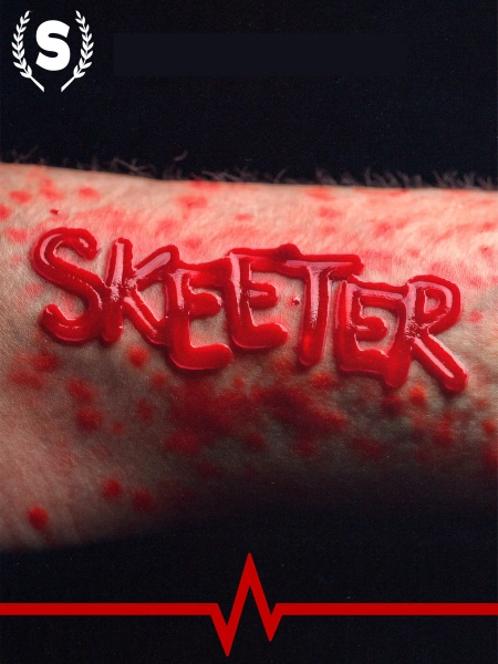 Skeeter
