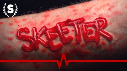 Skeeter