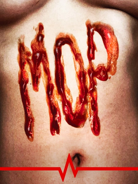 MOP