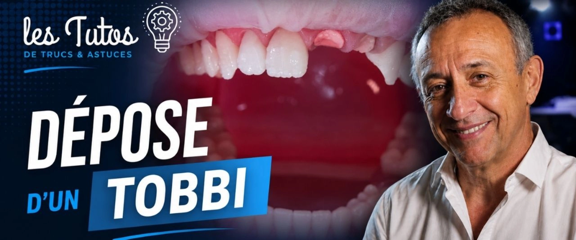 Dépose d'un tobbi