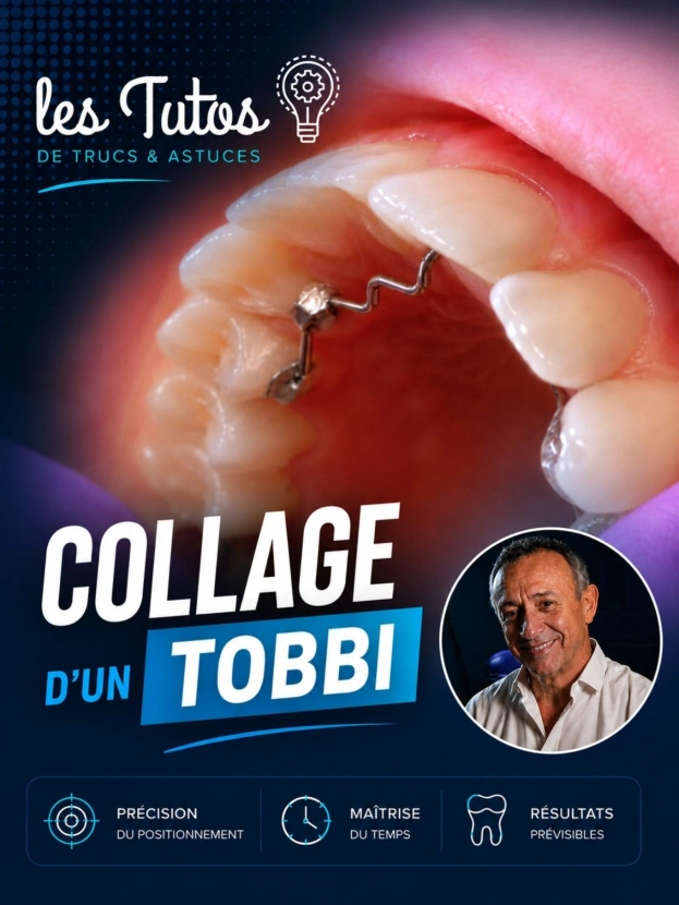 Dépose d'un tobbi