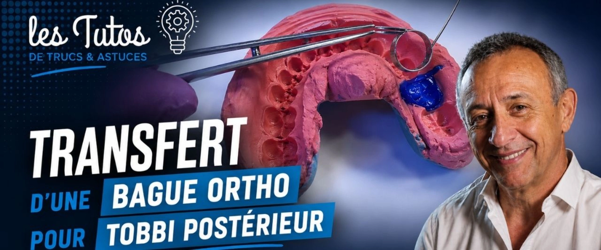 Transfert d une bague ortho pour tobbi postérieur