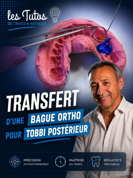 Transfert d une bague ortho pour tobbi postérieur