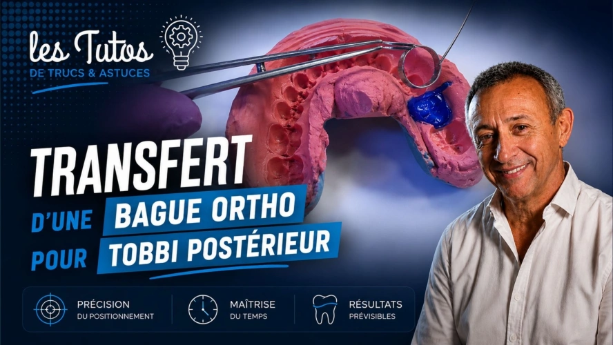 Transfert d une bague ortho pour tobbi postérieur