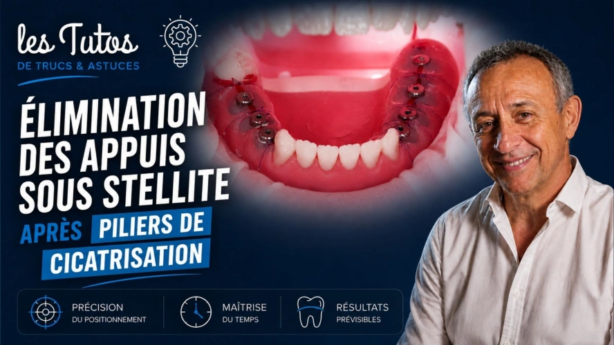 Elimination des appuis sous stellite après piliers de cicatrisation