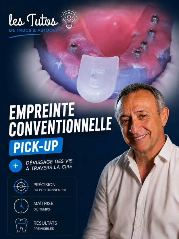 Empreinte conventionnelle pick up