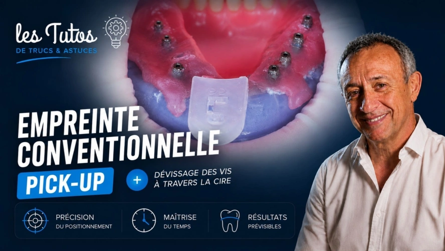 Empreinte conventionnelle pick up