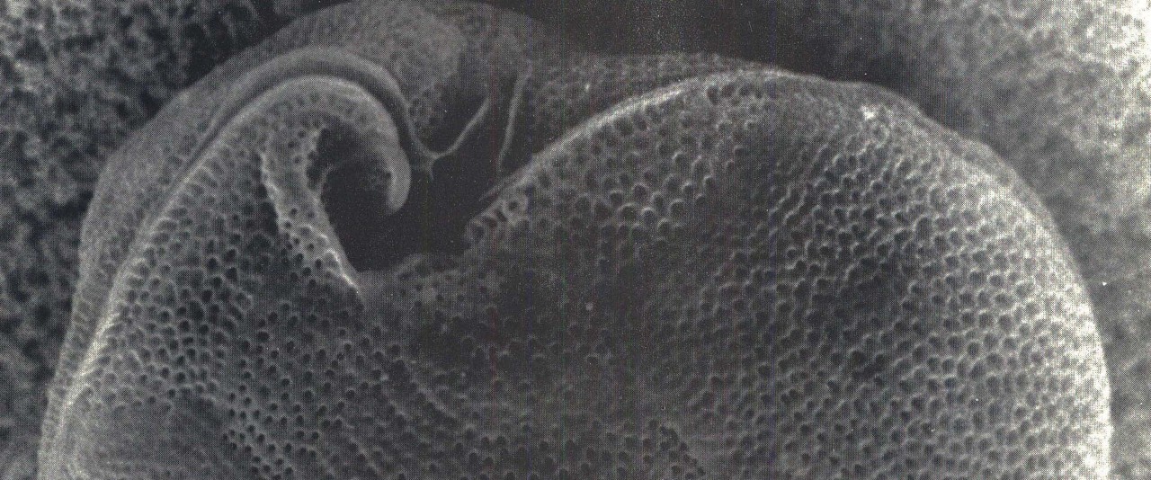 Hiro'a - Raymond Bagnis - Ciguatera, la découverte