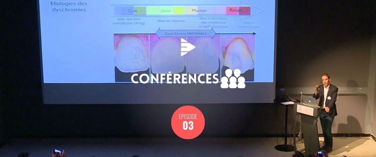 L'éclaircissement interne